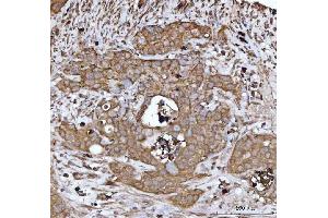 IHC analysis of DTR/HBEGF using anti-DTR/HBEGF antibody (ABIN7603042).