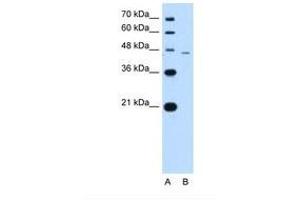 Image no. 1 for anti-SMAD, Mothers Against DPP Homolog 7 (SMAD7) (N-Term) antibody (ABIN324250) (SMAD7 Antikörper  (N-Term))