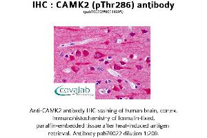Image no. 1 for anti-Calcium/calmodulin-Dependent Protein Kinase II beta (CAMK2B) (pThr286) antibody (ABIN1732578) (CAMK2B Antikörper  (pThr286))