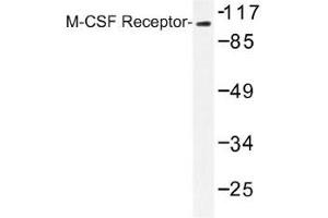 Image no. 1 for anti-Colony Stimulating Factor 1 Receptor (CSF1R) antibody (ABIN317880) (CSF1R Antikörper)