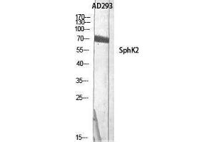 Western Blotting (WB) image for anti-Sphingosine Kinase 2 (SPHK2) (Tyr754) antibody (ABIN3177484) (SPHK2 Antikörper  (Tyr754))