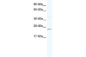 WB Suggested Anti-DNAJC17 Antibody Titration:  2. (DNAJC17 Antikörper  (N-Term))