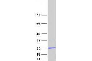 Western Blotting (WB) image for High Mobility Group AT-Hook 1 (HMGA1) (Transcript Variant 4) protein (Myc-DYKDDDDK Tag) (ABIN2722869)