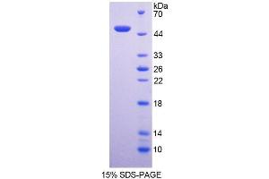 SDS-PAGE analysis of Human NCF1 Protein. (NCF1 Protein)