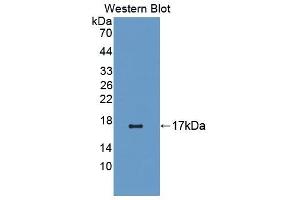 Detection of Recombinant CNR1, Rat using Polyclonal Antibody to Cannabinoid Receptor 1, Brain (CNR1) (CNR1 Antikörper  (AA 1-117))