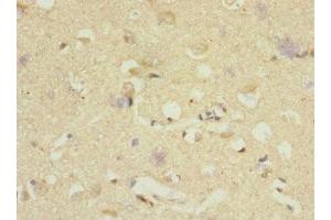 Immunohistochemistry of paraffin-embedded human brain tissue using ABIN7150518 at dilution of 1:100