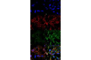 Immunocytochemistry/Immunofluorescence analysis using Mouse Anti-Acrolein Monoclonal Antibody, Clone 2H2 . (Acrolein Antikörper  (APC))