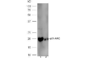 Line1,mouse intestinal lysate; Line2, Raji lysate probed with Rabbit Anti-p21-ARC Polyclonal Antibody, Unconjugated (ABIN2178124) at 1:300 in 4˚C. (ARPC3 Antikörper  (AA 2-100))