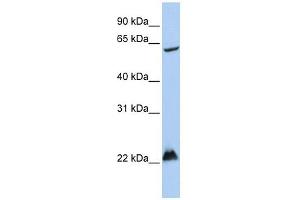 MGRN1 antibody used at 1 ug/ml to detect target protein. (Mahogunin RING Finger Protein 1 Antikörper  (Middle Region))