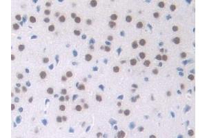 Immunohistochemistry (IHC) image for anti-Nucleophosmin (Nucleolar phosphoprotein B23, Numatrin) (NPM1) (AA 212-292) antibody (ABIN7438103)