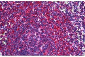 Human Spleen: Formalin-Fixed, Paraffin-Embedded (FFPE) (RALB Antikörper  (AA 89-183))