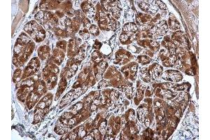 IHC-P Image CRHSP-24 antibody [N1C3] detects CRHSP-24 protein at cytoplasm in mouse prostate by immunohistochemical analysis. (CARHSP1 Antikörper)