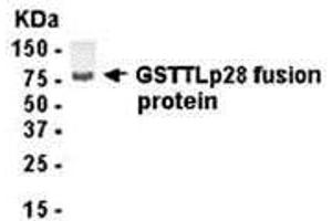 Western Blotting (WB) image for anti-Glutathione S-Transferase omega 1 (GSTO1) (AA 1-241) antibody (ABIN2468060) (GSTO1 Antikörper  (AA 1-241))