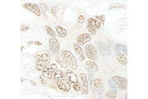 Immunohistochemistry (IHC) image for anti-SET Domain Containing 1B (SETD1B) (AA 350-400) antibody (ABIN7448602) (SETD1B Antikörper  (AA 350-400))