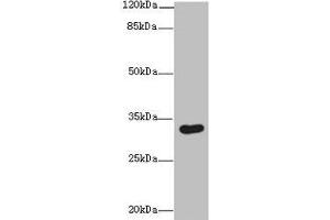Western blot All lanes: ASB8 antibody at 1 μg/mL + Human placenta tissue Secondary Goat polyclonal to rabbit IgG at 1/10000 dilution Predicted band size: 32 kDa Observed band size: 32 kDa (ASB8 Antikörper  (AA 12-288))
