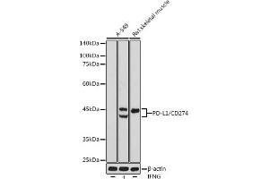 Western blot analysis of extracts of various cell lines, using PD-L1/CD274 antibody (ABIN6129976, ABIN6138153, ABIN6138154 and ABIN6215142) at 1:500 dilution. (PD-L1 Antikörper  (AA 19-238))