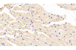 Detection of LTA4H in Mouse Cardiac Muscle Tissue using Polyclonal Antibody to Leukotriene A4 Hydrolase (LTA4H) (LTA4H Antikörper  (AA 135-272))