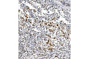 IHC analysis of POLR2A using anti-POLR2A antibody (ABIN7599598).