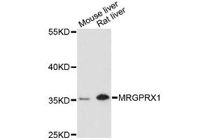 Western blot analysis of extracts of various cell lines, using MRGPRX1 antibody (ABIN6293323) at 1:3000 dilution. (MRGPRX1 Antikörper)