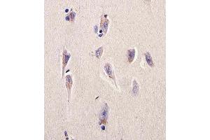 Immunohistochemical analysis of paraffin-embedded H. (Dihydrofolate Reductase Antikörper  (N-Term))