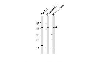 Western Blot at 1:2000 dilution Lane 1: PANC-1 whole cell lysate Lane 2: mouse cerebellum lysate Lane 3: rat cerebellum lysate Lysates/proteins at 20 ug per lane.