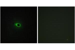 Immunofluorescence analysis of COS7 cells, using Collagen XII alpha1 Antibody. (COL12A1 Antikörper  (AA 1481-1530))