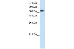 Transfected 293T; WB Suggested Anti-ZNF447 Antibody Titration: 1. (ZSCAN18 Antikörper  (N-Term))