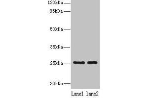 Western blot All lanes: NDFIP1 antibody at 8 μg/mL Lane 1: 293T whole cell lysate Lane 2: Hela whole cell lysate Secondary Goat polyclonal to rabbit IgG at 1/10000 dilution Predicted band size: 25, 17 kDa Observed band size: 25 kDa