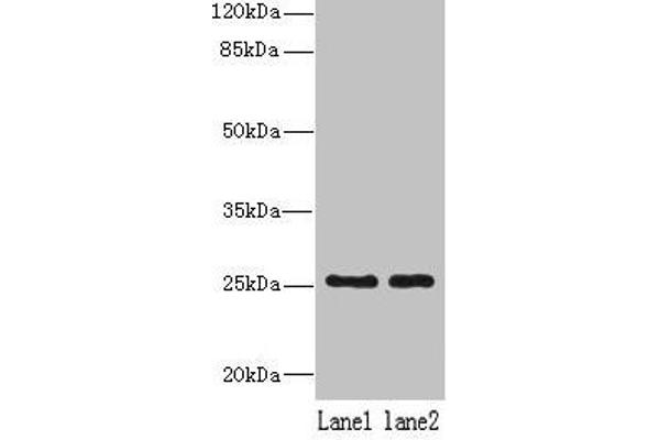 NDFIP1 anticorps  (AA 2-116)