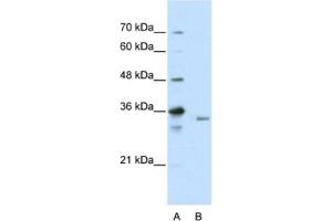 Western Blotting (WB) image for anti-Exosome Component 3 (EXOSC3) antibody (ABIN2462262) (EXOSC3 Antikörper)
