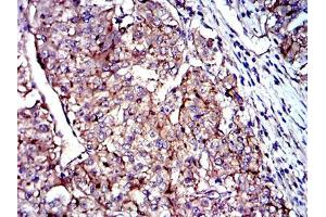 Immunohistochemistry (IHC) image for anti-CD9 (CD9) antibody (ABIN969030)