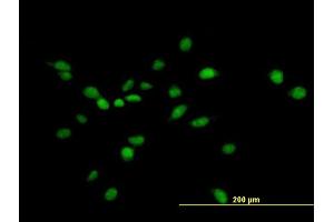 Immunofluorescence of purified MaxPab antibody to NUAK1 on HeLa cell.