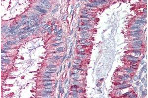 Human Uterus (formalin-fixed, paraffin-embedded) stained with GPR27 antibody ABIN410770 followed by biotinylated goat anti-rabbit IgG secondary antibody ABIN481713, alkaline phosphatase-streptavidin and chromogen. (GPR27 Antikörper  (Internal Region))
