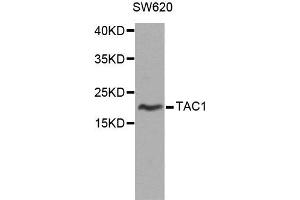 Western blot analysis of extracts of SW620 cells, using TAC1 antibody.