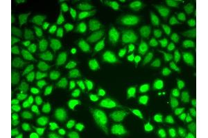 Immunofluorescence analysis of A549 cells using KDM1A antibody.