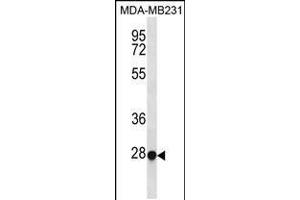Western blot analysis in MDA-MB231 cell line lysates (35ug/lane). (TFEC Antikörper  (AA 179-205))