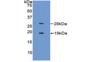 Detection of Recombinant FCN1, Human using Polyclonal Antibody to Sirtuin 1 (SIRT1) (SIRT1 Antikörper  (AA 244-498))