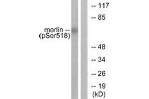 Western blot analysis of extracts from HuvEc cells treated with IFN-alpha 1000U/ml 18h, using Merlin (Phospho-Ser518) Antibody. (Merlin Antikörper  (pSer518))