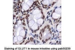 Image no. 1 for anti-Solute Carrier Family 2 (Facilitated Glucose Transporter), Member 1 (SLC2A1) (AA 1-100), (N-Term) antibody (ABIN363548) (GLUT1 Antikörper  (N-Term))