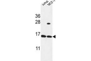 Western Blotting (WB) image for anti-Small Proline Rich Protein 1A (SPRR1A) antibody (ABIN3004230) (SPRR1A Antikörper)