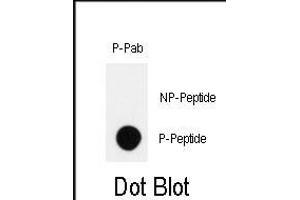 Dot blot analysis of anti-Phospho-HIPK2-p Antibody (ABIN389999 and ABIN2839776) on nitrocellulose membrane. (HIPK2 Antikörper  (pTyr361))