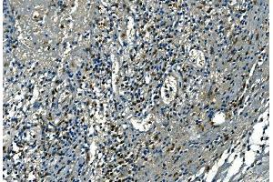 IHC analysis of Azurocidin/AZU1 using anti-Azurocidin/AZU1 antibody (ABIN7601000). (Azurocidin Antikörper  (AA 27-245))