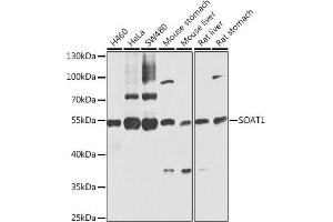 Western blot analysis of extracts of various cell lines, using SO antibody (ABIN6129624, ABIN6148259, ABIN6148260 and ABIN6221917) at 1:1000 dilution. (SOAT1 Antikörper  (AA 1-130))