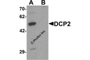 Western Blotting (WB) image for anti-DCP2 Decapping Enzyme Homolog (DCP2) (C-Term) antibody (ABIN1077379) (DCP2 Antikörper  (C-Term))