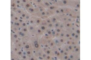 Used in DAB staining on fromalin fixed paraffin- embedded Kidney tissue (DP1 Antikörper  (AA 6-410))
