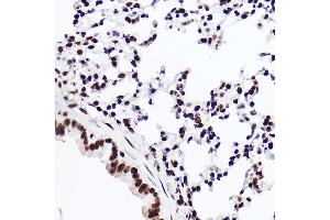 Immunohistochemistry of paraffin-embedded mouse lung using MonoMethyl-Histone H3-K18 Rabbit mAb (ABIN7267683) at dilution of 1:100 (40x lens).