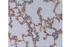Used in DAB staining on fromalin fixed paraffin- embedded lung tissue (CSK Antikörper  (AA 243-438))