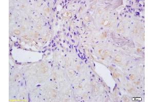 Formalin-fixed and paraffin embedded human stomach labeled with Rabbit Anti ACTRIC/Activin A Receptor Type IC Polyclonal Antibody, Unconjugated (ABIN714596) at 1:200 followed by conjugation to the secondary antibody and DAB staining (ACVR1C/ALK7 Antikörper  (AA 21-120))