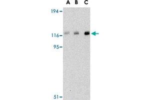 Western blot analysis of CBL in Daudi cell lysate with CBL polyclonal antibody  at (A) 0. (CBL Antikörper  (C-Term))