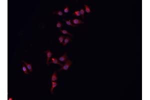 ABIN6266833 staining HeLa  cells by IF/ICC.